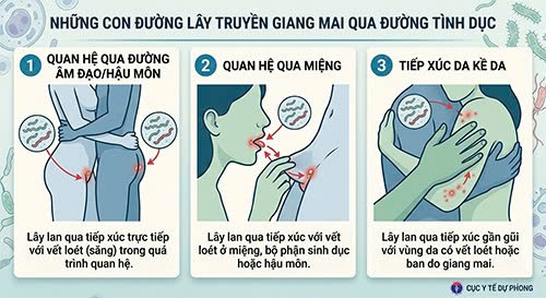 Bạn trai bị giang mai có quan hệ được không?
